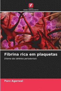 bokomslag Fibrina rica em plaquetas