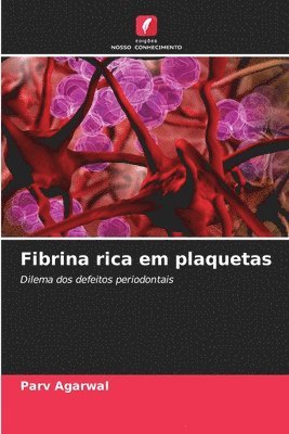 Fibrina rica em plaquetas 1