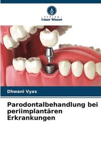 bokomslag Parodontalbehandlung bei periimplantren Erkrankungen