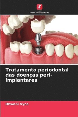 bokomslag Tratamento periodontal das doenas peri-implantares