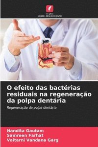 bokomslag O efeito das bactrias residuais na regenerao da polpa dentria
