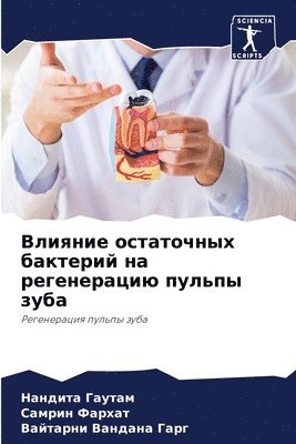 bokomslag &#1042;&#1083;&#1080;&#1103;&#1085;&#1080;&#1077; &#1086;&#1089;&#1090;&#1072;&#1090;&#1086;&#1095;&#1085;&#1099;&#1093; &#1073;&#1072;&#1082;&#1090;&#1077;&#1088;&#1080;&#1081; &#1085;&#1072;