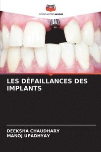 bokomslag Les Dfaillances Des Implants