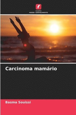 Carcinoma mamrio 1