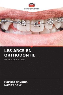 Les Arcs En Orthodontie 1