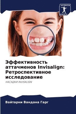 bokomslag &#1069;&#1092;&#1092;&#1077;&#1082;&#1090;&#1080;&#1074;&#1085;&#1086;&#1089;&#1090;&#1100; &#1072;&#1090;&#1090;&#1072;&#1095;&#1084;&#1077;&#1085;&#1086;&#1074; Invisalign