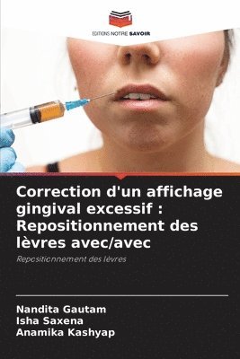 Correction d'un affichage gingival excessif 1