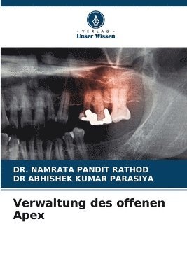 Verwaltung des offenen Apex 1