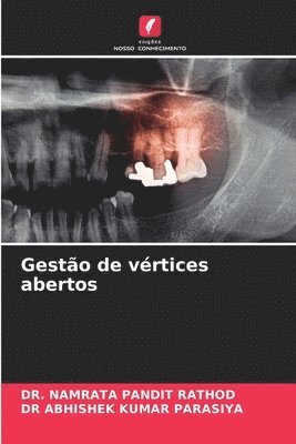 Gesto de vrtices abertos 1