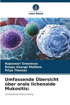 bokomslag Umfassende bersicht ber orale lichenoide Mukositis