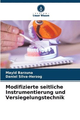 Modifizierte seitliche Instrumentierung und Versiegelungstechnik 1