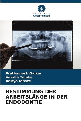 bokomslag Bestimmung Der Arbeitslnge in Der Endodontie