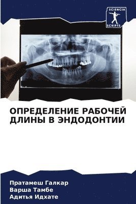 Пратамеш Галкар, Варша Тамбе, Адитья Идхате, &#1043;&#1072;&#1083;&#1082;&#1072;&#108, &#1 &#1058;&#1072;&#1084;&#1073;&#1077;, ¿¿¿¿¿¿¿¿ ¿¿¿¿¿¿, ¿¿¿¿¿ ¿¿¿¿¿, Pratamesh Galkar - ОПРЕДЕЛЕНИЕ РАБОЧЕЙ ДЛИНЫ В ЭНДОДОНТИИ, Häftad