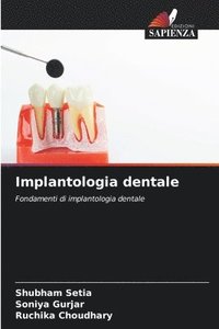 bokomslag Implantologia dentale