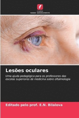 Leses oculares 1