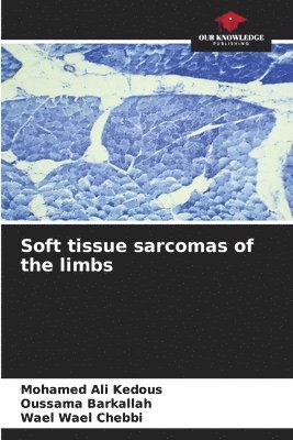 Soft tissue sarcomas of the limbs 1