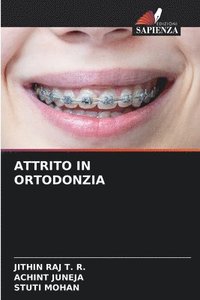 bokomslag Attrito in Ortodonzia