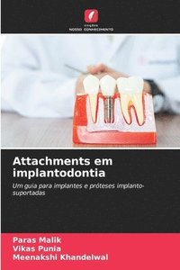 bokomslag Attachments em implantodontia