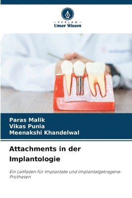 Attachments in der Implantologie 1