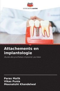 bokomslag Attachements en implantologie