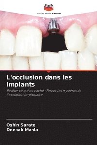 bokomslag L'occlusion dans les implants