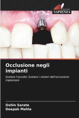 bokomslag Occlusione negli impianti