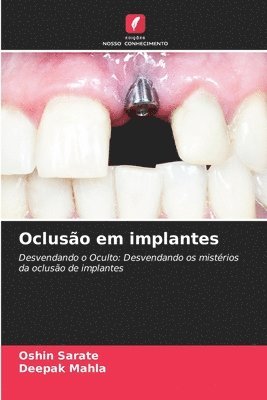 Ocluso em implantes 1