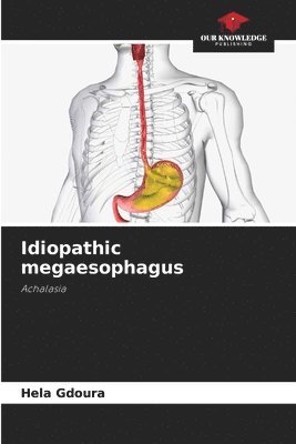 Idiopathic megaesophagus 1