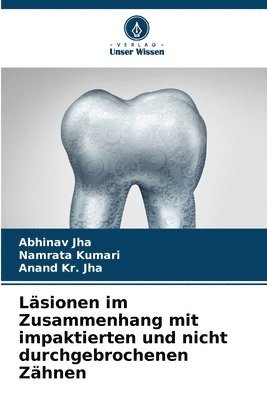 bokomslag Lsionen im Zusammenhang mit impaktierten und nicht durchgebrochenen Zhnen