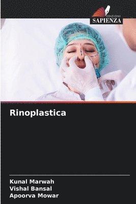 Rinoplastica 1