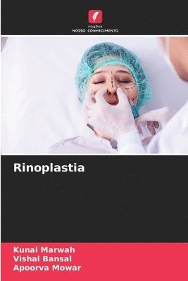 Rinoplastia 1