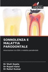 bokomslag Sonnolenza E Malattia Parodontale