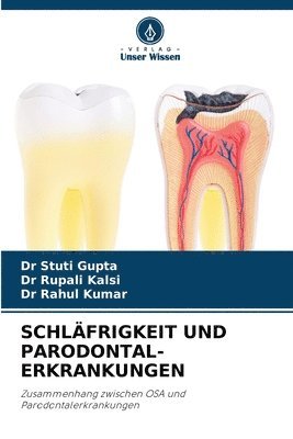 bokomslag Schlfrigkeit Und Parodontal- Erkrankungen