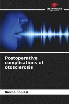 bokomslag Postoperative complications of otosclerosis