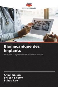 bokomslag Biomcanique des implants