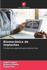 bokomslag Biomecnica de implantes