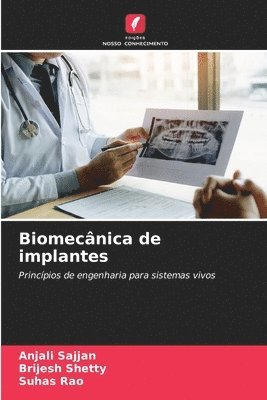 Biomecnica de implantes 1