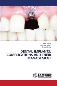 bokomslag Dental Implants