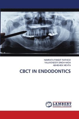 Cbct in Endodontics 1