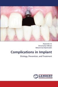 bokomslag Complications in Implant
