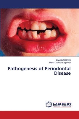 bokomslag Pathogenesis of Periodontal Disease