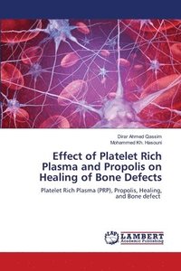 bokomslag Effect of Platelet Rich Plasma and Propolis on Healing of Bone Defects