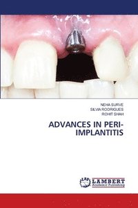 bokomslag Advances in Peri-Implantitis