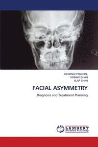 bokomslag Facial Asymmetry