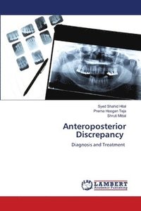 bokomslag Anteroposterior Discrepancy