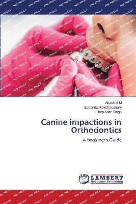 Canine impactions in Orthodontics 1