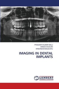 bokomslag Imaging in Dental Implants