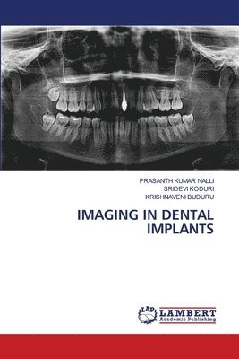 Imaging in Dental Implants 1