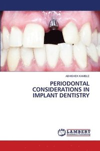 bokomslag Periodontal Considerations in Implant Dentistry