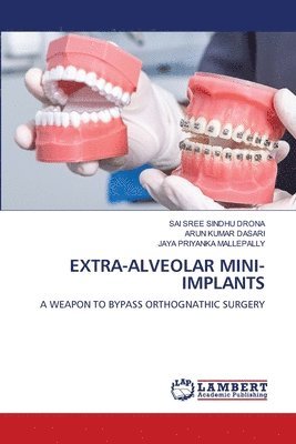 Extra-Alveolar Mini-Implants 1
